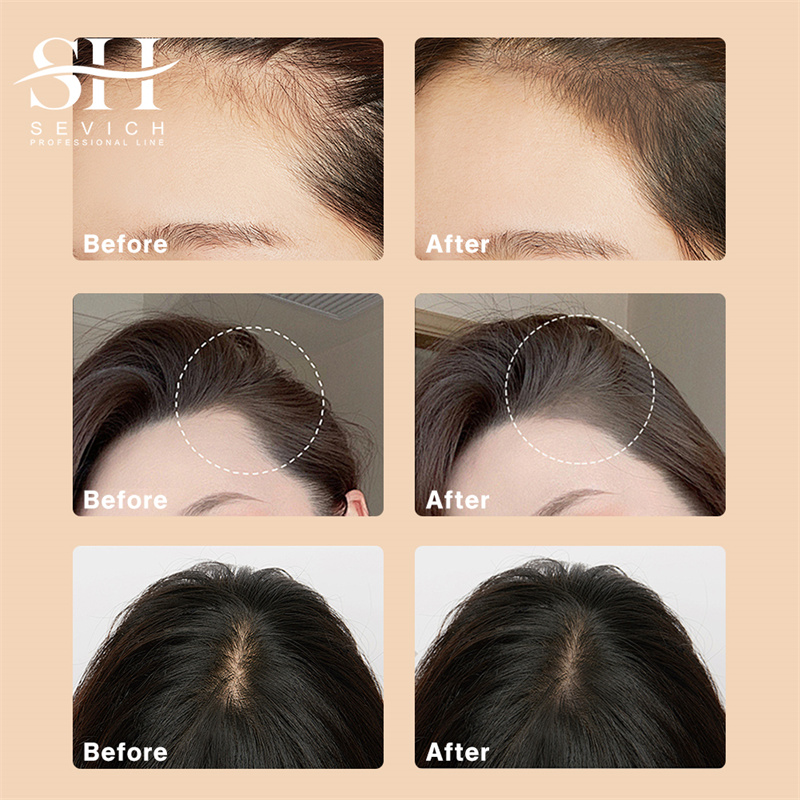 SEVICH 12g Hairline Powder Wit - Rooting Hormone Powder ulasan dan harga